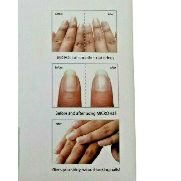 Emjoi Micro Nail Polisher Buffs Smooths Shines DIY Healthy Nails Home Care Kit - Picture 9 of 11